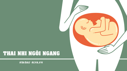 Những vị trí nằm “oái oăm” của thai nhi trong bụng mẹ